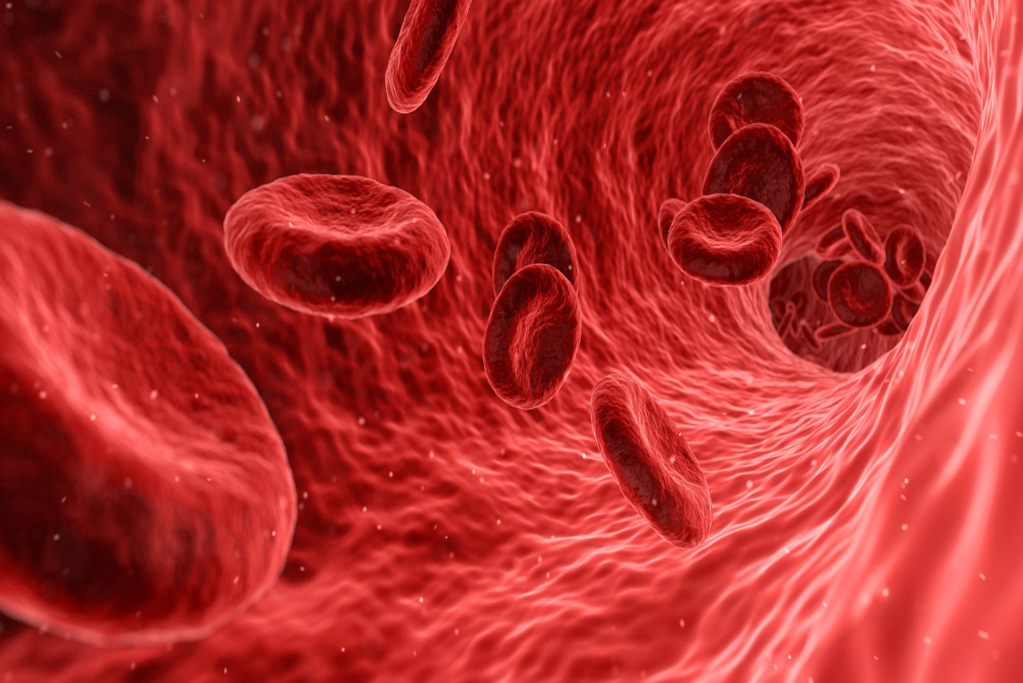 Atheromatosis