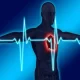 Acute pericarditis