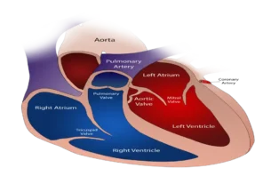 mitral valve prolapse